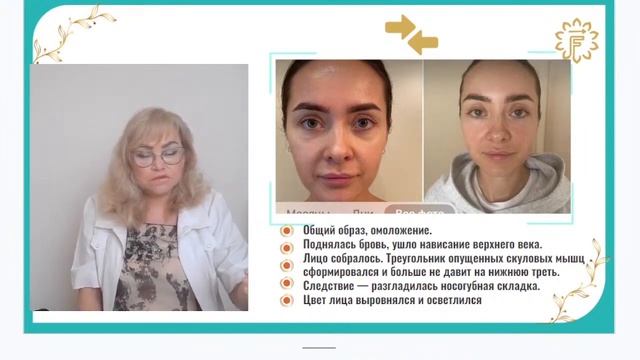 Подборка до и после курса векторного массажа лица.