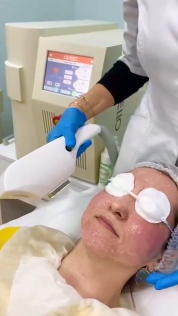 Фотоомоложение лица в медицинском центре "Медео"
