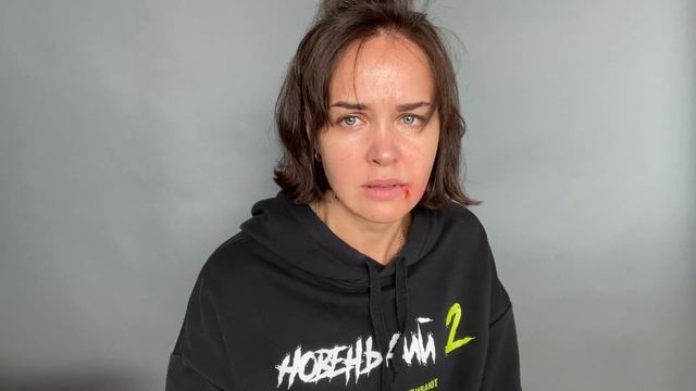 Избитая женщина. Екатерина Лутова. 37 лет. КМ.