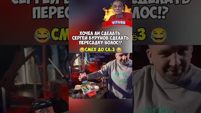 Хотел ли Сергей Бурунов сделать пересадку волос !?