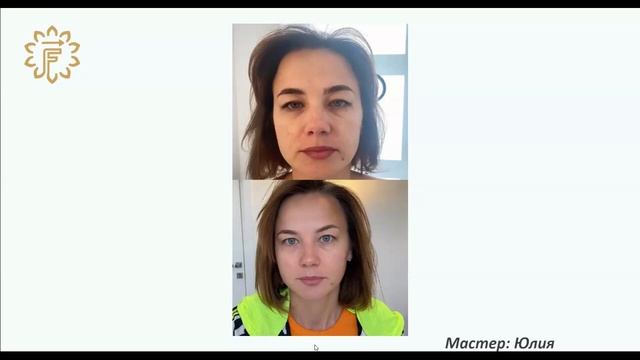 Разбор результатов векторного массажа лица. Демонстрация до после.