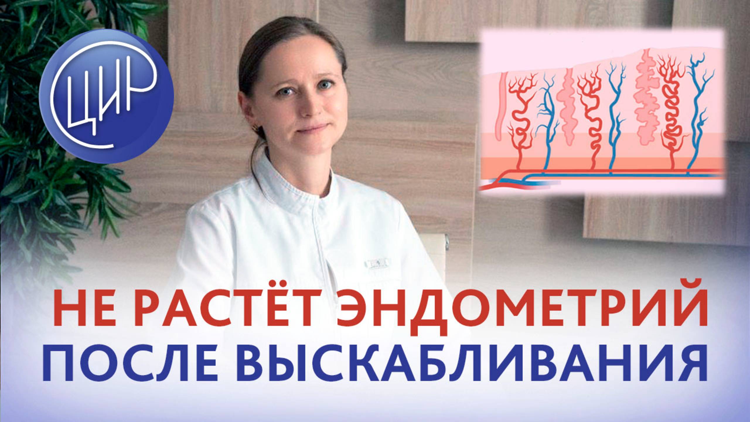 Не растёт эндометрий после выскабливания. Нужны ли метипред, плаквенил, иммуноглобулины?