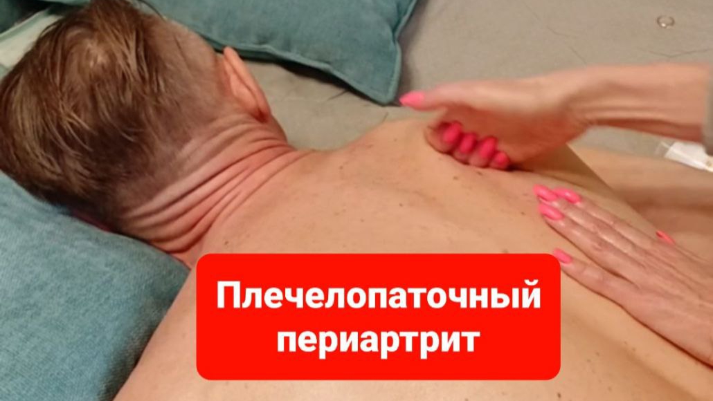 Что делать когда болит плечо?Трудно поднять руку, есть решение.Плечелопаточный периартрит