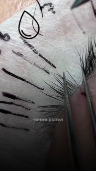 Для чего нужна микрокапля?!