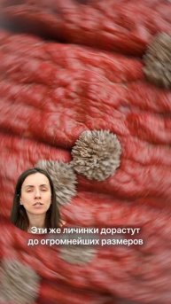 Глисты в мясе - что вам не говорят