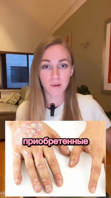 Паразиты есть у всех!