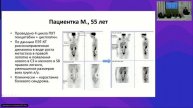Метастатический уротелиальный рак. Случаи из практики с обсуждением панелью экспертов