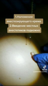 Этапы удаления кожных образований