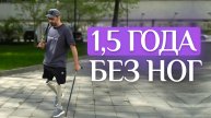 Я не жертва, я – воин! Как я научился ходить заново и что нужно знать после ампутации двух ног ?!
