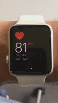 Как Apple Watch спасли жизнь человеку!