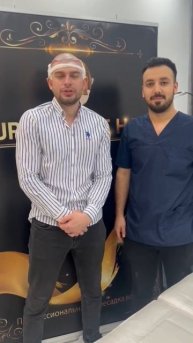 Пересадка волос после отлично операции #пересадкавол?