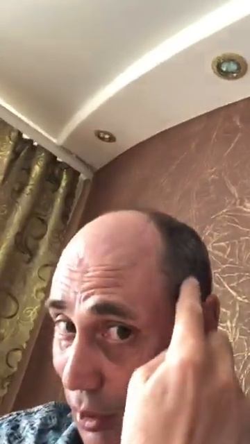 Начали расти волосы на лысой голове