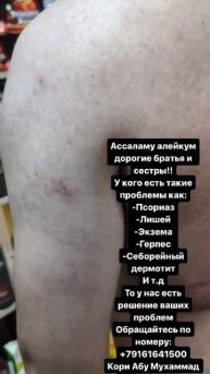 У кого есть такие проблемы мы нашли для вас решения #то