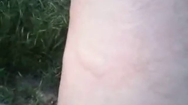 борщевик может кусаться!