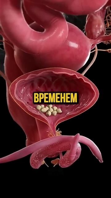 Так выглядит почка, если есть по ночам