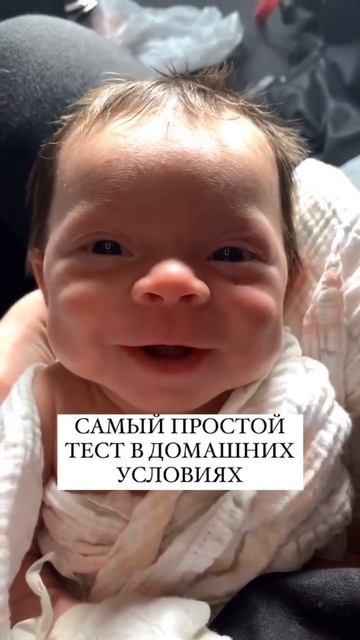 ЭТО ВАЖНО ЗНАТЬ! КАКОЙ ФОРМЫ ГОЛОВА МАЛЫША #онлайнконс