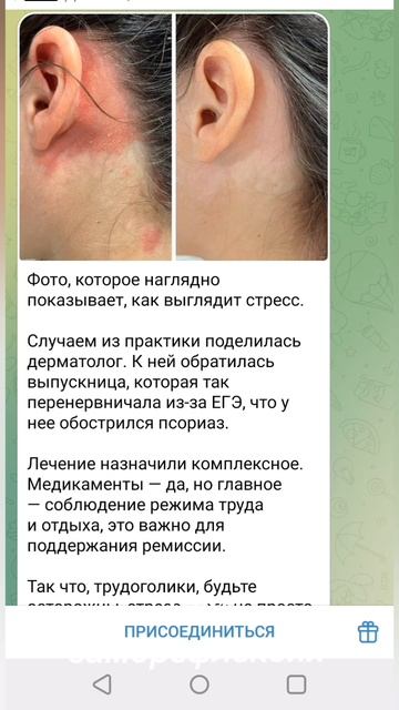 "ДЕЛАЙ КАК Я СКАЗАЛ(А)",НАПАДЕНИЕ КРИКОМ