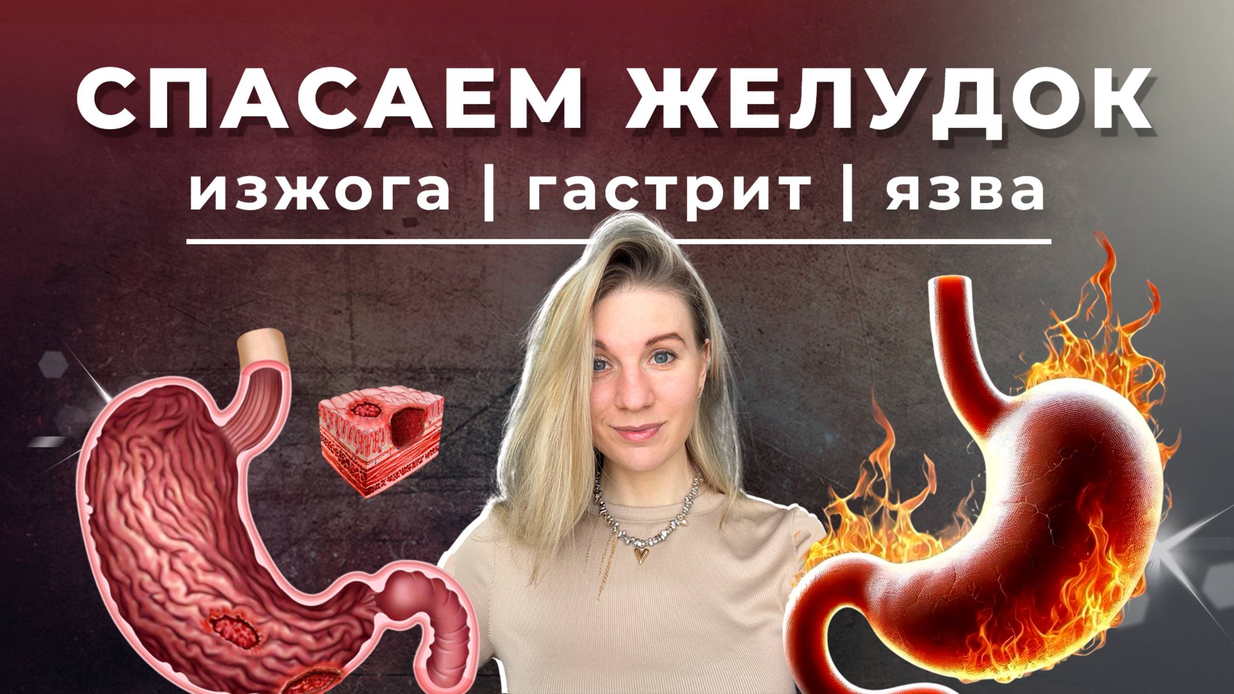 Спасаем желудок! Изжога, гастрит, язва