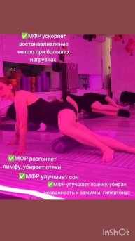 МФР