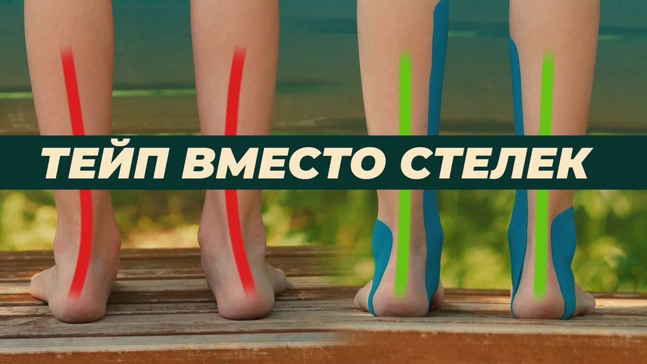 Тейп вместо стелек. Поддержка стопы в открытой обуви для детей и взрослых.
