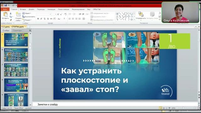 Плоскостопие и завал стоп. Откуда берется плоскостопие и как его скорректировать?
