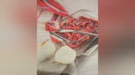 Сельдь,маринованная по- корейски.