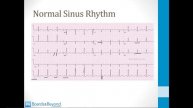 Cardiology - 3. EKGs - 2.High Yield EKGs atf