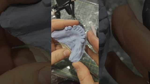 Выпирающая кость или экзостоз.