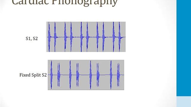Cardiology - 5. Cardiac Auscultation - 2.Heart Sounds atf