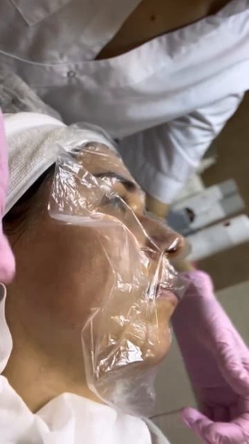 Чистка лица в PRO Estetica