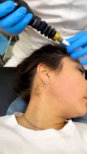 Скидка на ВНЧС 50%