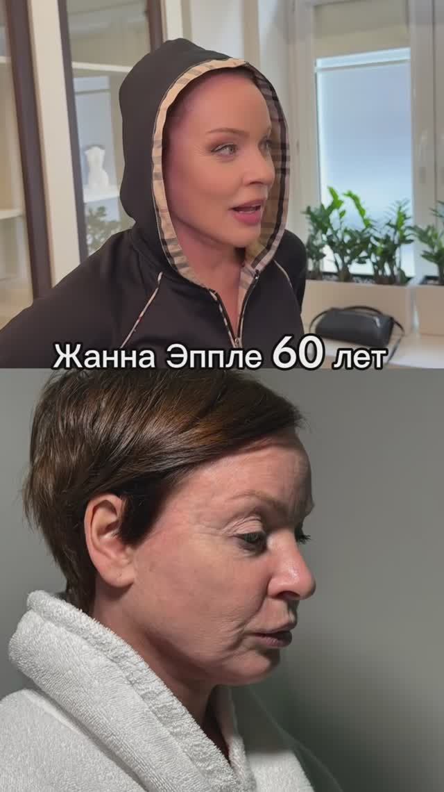Шикарная Жанна Эппле после невидимой подтяжки лица! #подтяжкалица #сергейсвиридов #жаннаэппле
