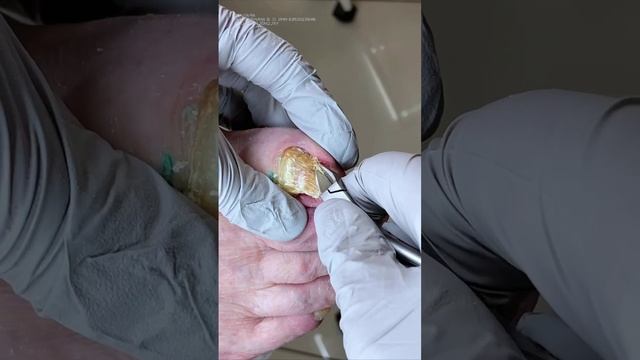 Бабушке 76 лет