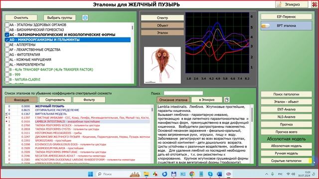 2024-07-30_131145-ПО Дианел®-2.1. обучение, Работа с эталонами, анализ вероятности процессов,примеры