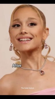 Celebrity Plastic Surgery: Before-and-After Pics.