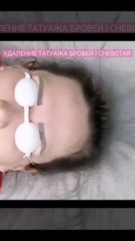 УДАЛЕНИЕ ТАТУАЖА ПЕРМАНЕНТА БРОВЕЙ | ЭЖВА CHEBOTAR'