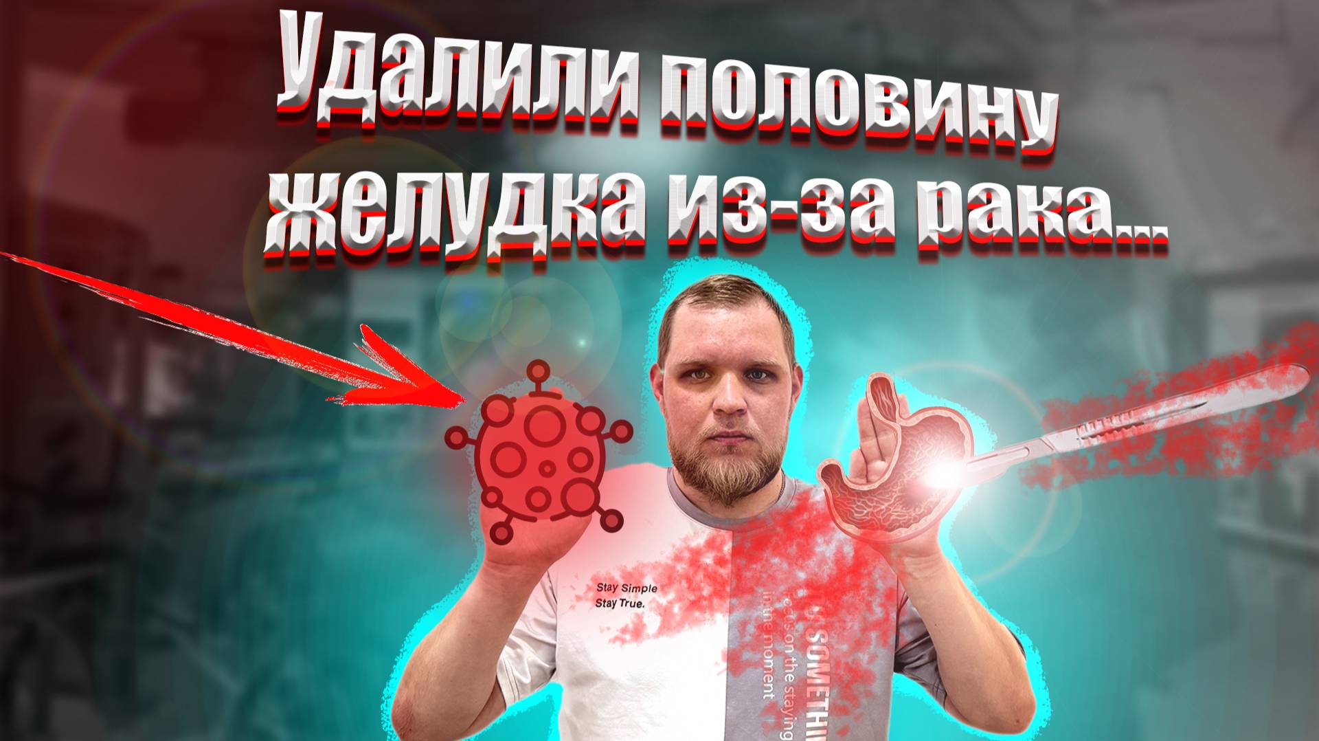 прошел ОПЕРАЦИЮ ПО УДАЛЕНИЮ РАКА ЖЕЛУДКА: испытал ТЯЖЕЛЫЕ НА*КОТИКИ на себе