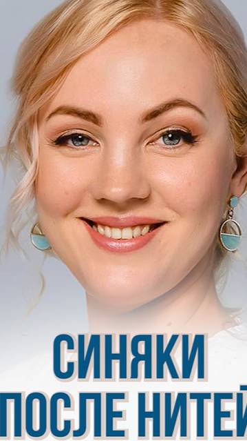 СИНЯКИ ПОСЛЕ НИТЕЙ. СЕРЬЁЗНЫЕ ТРАВМЫ? #Нитеваяподтяжка #Нитевойлифтинг