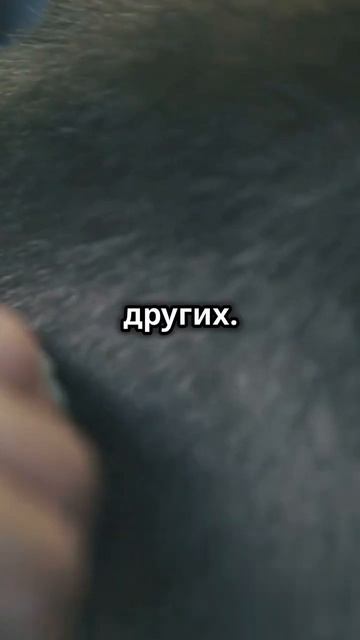 Почему мужчины делают пересадку волос? #shorts