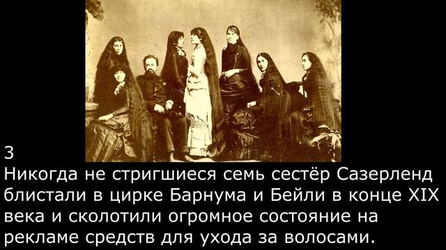 Топ 15 людей из цирка уродов