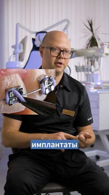 Скидка 20% на имплант с коронкой. OSSTEM, Ankylos, Straumann. Запись