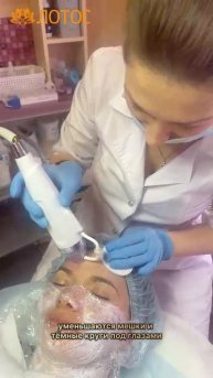 RF лифтинг лица