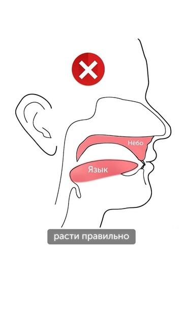 Настоящая причина скученности зубов #
