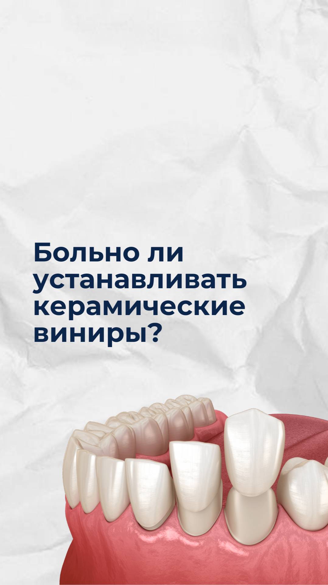 Больно ли устанавливать керамические виниры