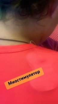 Миостимулятор для мышц #алтайскийкрай #миостимулятор?