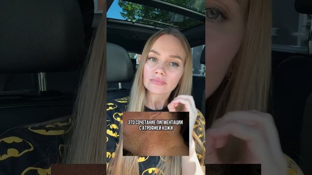 ⛔ Не брызгайте духи на кожу перед выходом на солнце!