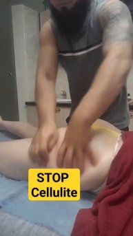 Stop Cellulite. Стоп целлюлит. Антицеллюлитный массаж #cellulite #