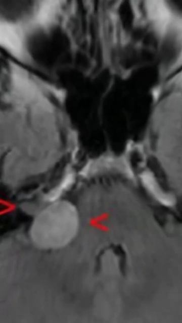 Газированная вода творит чудеса с организмом #стройно