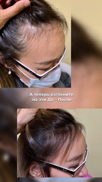 Залысины без пересадки: решение найдено!