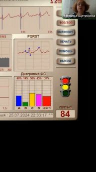 массажный гель, результат диагностики #бютилайф #здор?